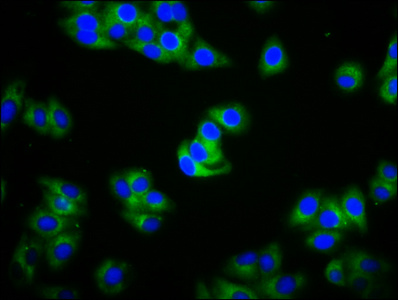 IGHA2 Antibody - Immunofluorescence staining of HepG2 cells diluted at 1:100, counter-stained with DAPI. The cells were fixed in 4% formaldehyde, permeabilized using 0.2% Triton X-100 and blocked in 10% normal Goat Serum. The cells were then incubated with the antibody overnight at 4°C.The Secondary antibody was Alexa Fluor 488-congugated AffiniPure Goat Anti-Rabbit IgG (H+L).