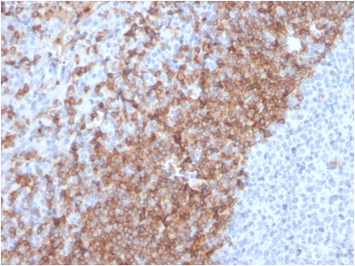 IGHD Antibody - Formalin-fixed, paraffin-embedded human Tonsil stained with IgD Recombinant Rabbit Monoclonal Antibody (IGHD/2730R).
