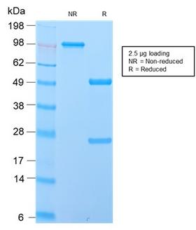 IGHD Antibody - SDS-PAGE Analysis Purified IgD Rabbit Recombinant Monoclonal Antibody (IGHD/2730R). Confirmation of Purity and Integrity of Antibody.