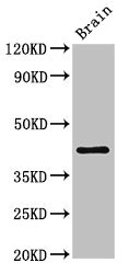 IGHD Antibody - Western Blot Positive WB detected in:Mouse brain tissue All Lanes:IGHD antibody at 3µg/ml Secondary Goat polyclonal to rabbit IgG at 1/50000 dilution Predicted band size: 43,38 KDa Observed band size: 43 KDa