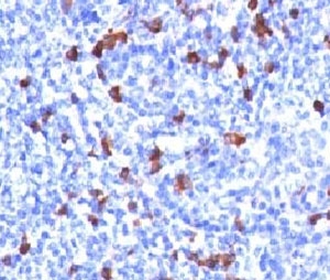 IGHG1 / IgG Antibody - IHC testing of human tonsil and IgG antibody (GHC07-1).  This image was taken for the unmodified form of this product. Other forms have not been tested.