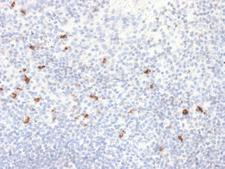 IGHG4 Antibody - Formalin-fixed, paraffin-embedded Human Tonsil stained with IgG4 Recombinant Rabbit Monoclonal Antibody (IGHG4/2042R).