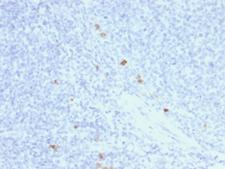 IGHG4 Antibody - Formalin-fixed, paraffin-embedded Human Tonsil stained with IgG4 Mouse Recombinant Monoclonal Antibody (rIGHG4/1345).