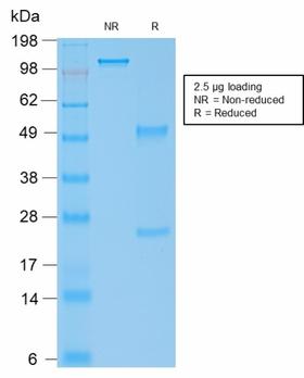 IGHG4 Antibody - SDS-PAGE Analysis Purified IgG4 Mouse Recombinant Monoclonal Antibody (rIGHG4/1345). Confirmation of Purity and Integrity of Antibody.