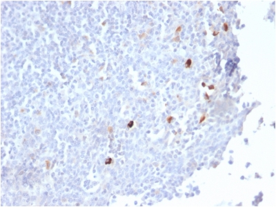 IGHM / IgM Antibody - Formalin-fixed, paraffin-embedded human Tonsil stained with IgM Rabbit Recombinant Monoclonal Antibody (IGHM/2559R).