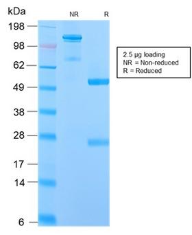 IGHM / IgM Antibody - SDS-PAGE Analysis Purified IgM Rabbit Recombinant Monoclonal Antibody (IGHM/2559R). Confirmation of Purity and Integrity of Antibody.