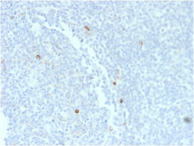 IGHM / IgM Antibody - Formalin-fixed, paraffin-embedded human Tonsil stained with IgM Mouse Recombinant Monoclonal Antibody (rIM373).