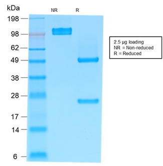 IGHM / IgM Antibody - SDS-PAGE Analysis Purified IgM Mouse Recombinant Monoclonal Antibody (rIM373). Confirmation of Purity and Integrity of Antibody.