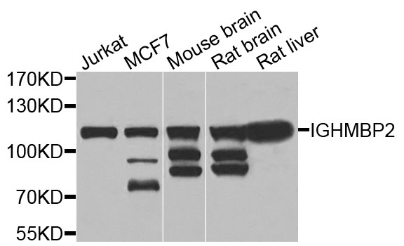 IGHMBP2 Antibody - Western blot analysis of extracts of various cells.