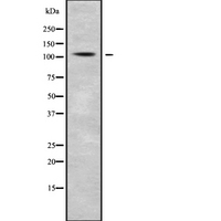 IGHMBP2 Antibody - Western blot analysis IGHMBP2 using Jurkat whole cells lysates