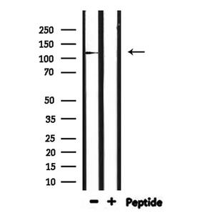 IGHMBP2 Antibody - Western blot analysis of extracts of mouse kidney using IGHMBP2 antibody.