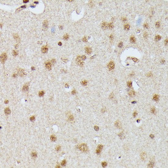 IGHMBP2 Antibody - Immunohistochemistry of paraffin-embedded Rat brain using IGHMBP2 Polyclonal Antibody at dilution of 1:100 (40x lens).