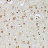 IGHMBP2 Antibody - Immunohistochemistry of paraffin-embedded Rat brain using IGHMBP2 Polyclonal Antibody at dilution of 1:100 (40x lens).