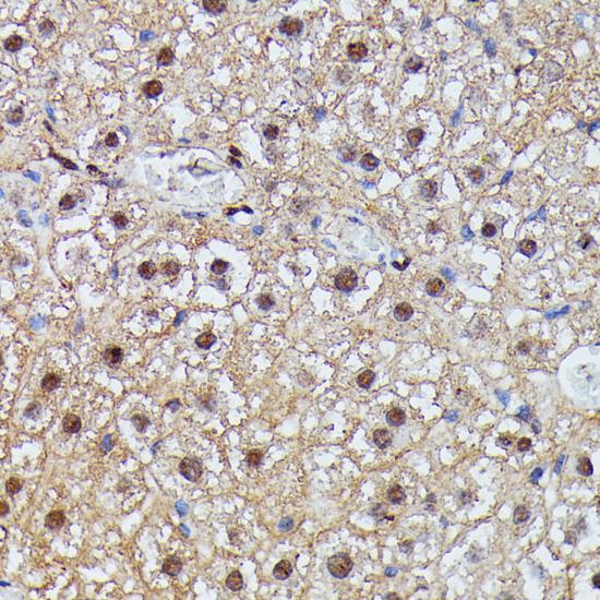 IGHMBP2 Antibody - Immunohistochemistry of paraffin-embedded Mouse liver using IGHMBP2 Polyclonal Antibody at dilution of 1:100 (40x lens).