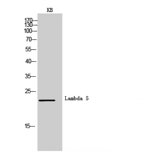 IGLL1 / CD179b Antibody - Western blot of Lambda 5 antibody