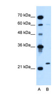 IGLL1 / CD179b Antibody - IGLL1 antibody ARP42547_T100-NP_064455-IGLL1(immunoglobulin lambda-like polypeptide 1) Antibody Western blot of Jurkat lysate.  This image was taken for the unconjugated form of this product. Other forms have not been tested.