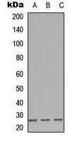 IGLL1 / CD179b Antibody - Western blot analysis of CD179b expression in A549 (A); NS-1 (B); PC12 (C) whole cell lysates.