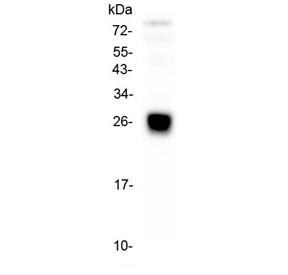 IGLL1 / CD179b Antibody - Western blot testing of human placenta lysate with IGLL1 antibody at 0.5ug/ml. Predicted molecular weight ~23 kDa.