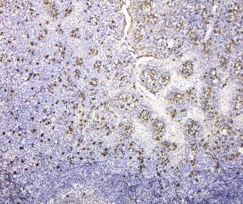 IGLL1 / CD179b Antibody - IHC staining of FFPE human tonsil tissue with IGLL1 antibody at 1ug/ml. HIER: boil tissue sections in pH6, 10mM citrate buffer, for 10-20 min and allow to cool before testing.
