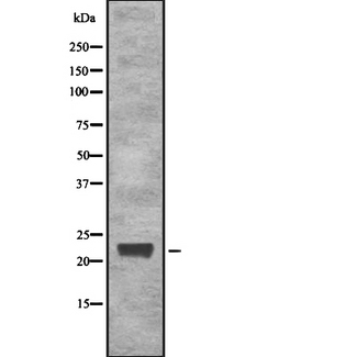IGLL1 / CD179b Antibody - Western blot analysis of CD179b using LOVO cells whole cells lysates