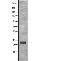 IGLL1 / CD179b Antibody - Western blot analysis of CD179b using LOVO cells whole cells lysates