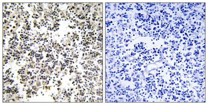 IGLL1 / CD179b Antibody - Peptide - + Immunohistochemistry analysis of paraffin-embedded human lymph node tissue using IGLL1 antibody.