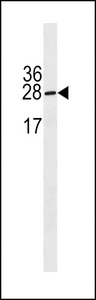 IGLL5 Antibody - IGLL5 Antibody western blot of HepG2 cell line lysates (35 ug/lane). The IGLL5 Antibody detected the IGLL5 protein (arrow).