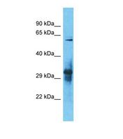 IGLON5 Antibody - Western blot of Human 721_B. IGLON5 antibody dilution 1.0 ug/ml.  This image was taken for the unconjugated form of this product. Other forms have not been tested.