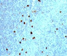 IgM Heavy Chain Antibody - IgM Heavy Chain antibody IM373 immunohistochemistry tonsil.  This image was taken for the unmodified form of this product. Other forms have not been tested.
