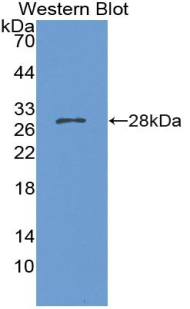 IGSF1 Antibody - Western blot of recombinant IGSF1.