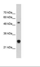 IGSF1 Antibody - HepG2 Cell Lysate.  This image was taken for the unconjugated form of this product. Other forms have not been tested.