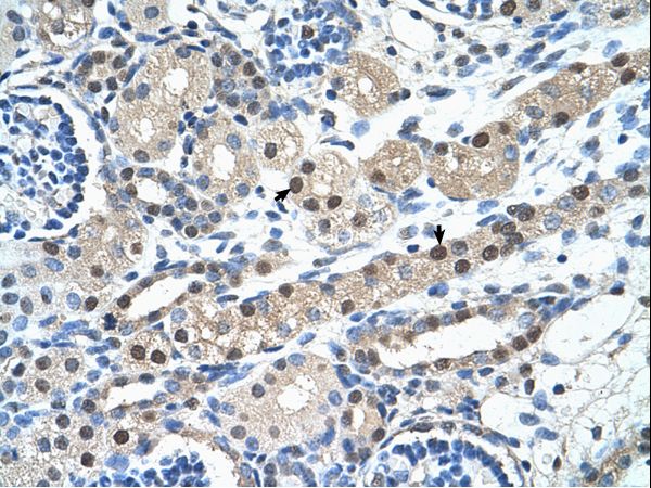 IGSF1 Antibody - IGSF1 antibody ARP41953_T100-NP_991402-IGSF1(immunoglobulin superfamily, member 1) Antibody was used in IHC to stain formalin-fixed, paraffin-embedded human kidney.  This image was taken for the unconjugated form of this product. Other forms have not been tested.