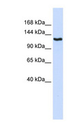 IGSF1 Antibody - IGSF1 antibody Western blot of 293T cell lysate. This image was taken for the unconjugated form of this product. Other forms have not been tested.