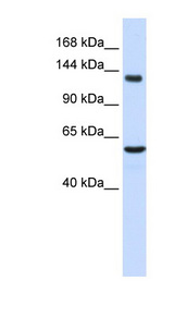 IGSF1 Antibody - IGSF1 antibody Western blot of Fetal Liver lysate. This image was taken for the unconjugated form of this product. Other forms have not been tested.