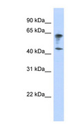 IGSF11 / VSIG3 Antibody - IGSF11 antibody Western blot of Transfected 293T cell lysate. This image was taken for the unconjugated form of this product. Other forms have not been tested.
