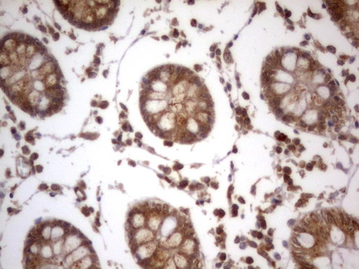 IGSF11 / VSIG3 Antibody - IHC of paraffin-embedded Human colon tissue using anti-IGSF11 mouse monoclonal antibody. (Heat-induced epitope retrieval by 1 mM EDTA in 10mM Tris, pH8.5, 120°C for 3min).