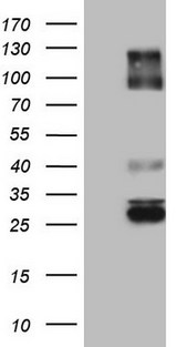IGSF11 / VSIG3 Antibody - Human recombinant protein fragment corresponding to amino acids 23-241 of human IGSF11 (NP_689751) produced in E.coli.