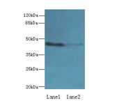 IGSF11 / VSIG3 Antibody - Western blot. All lanes: IGSF11 antibody at 1.5 ug/ml. Lane 1: Mouse brain tissue. Lane 2: Jurkat whole cell lysate. Secondary Goat polyclonal to Rabbit IgG at 1:10000 dilution. Predicted band size: 46 kDa. Observed band size: 46 kDa.