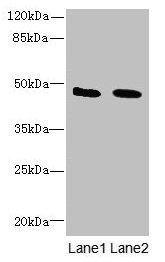 IGSF11 / VSIG3 Antibody - Western blot All lanes: IGSF11 antibody at 1.5µg/ml Lane 1: Mouse brain tissue Lane 2: Jurkat whole cell lysate Secondary Goat polyclonal to rabbit IgG at 1/10000 dilution Predicted band size: 47, 44 kDa Observed band size: 47 kDa