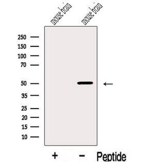 IGSF21 Antibody - Western blot analysis of extracts of mouse brain tissue using IGSF21 antibody. The lane on the left was treated with blocking peptide.