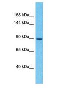 IGSF22 Antibody - IGSF22 antibody Western Blot of PANC1. Antibody dilution: 1 ug/ml.  This image was taken for the unconjugated form of this product. Other forms have not been tested.