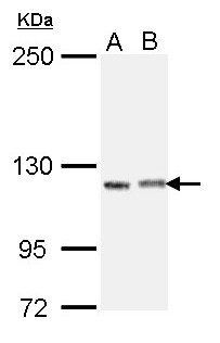 IGSF3 Antibody - Sample (30 ug of whole cell lysate). A: H1299, B: Raji. 5% SDS PAGE. IGSF3 antibody diluted at 1:1000.