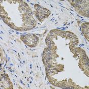 IGSF3 Antibody - Immunohistochemistry of paraffin-embedded Human prostate using IGSF3 Polyclonal Antibody.
