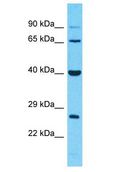 IGSF4C / CADM4 Antibody - IGSF4C / CADM4 antibody Western Blot of NCI-H226. Antibody dilution: 1 ug/ml.  This image was taken for the unconjugated form of this product. Other forms have not been tested.