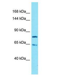 IGSF9B Antibody - IGSF9B antibody Western Blot of Jurkat. Antibody dilution: 1 ug/ml.  This image was taken for the unconjugated form of this product. Other forms have not been tested.
