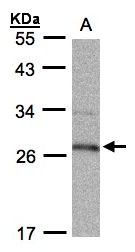 15-PGDH / HPGD Antibody - Sample (30g whole cell lysate). A: Raji . 12% SDS PAGE. 15-PGDH / HPGD antibody diluted at 1:1000