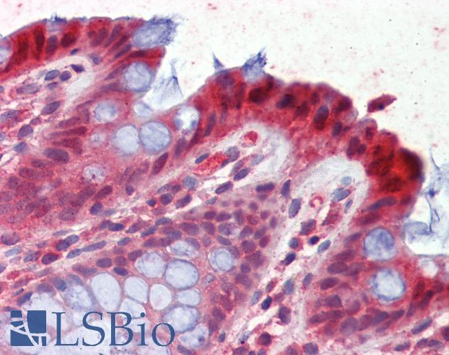 15-PGDH / HPGD Antibody - Anti-HPGD / 15-PGDH antibody IHC of human colon. Immunohistochemistry of formalin-fixed, paraffin-embedded tissue after heat-induced antigen retrieval. Antibody concentration 2.5 ug/ml.