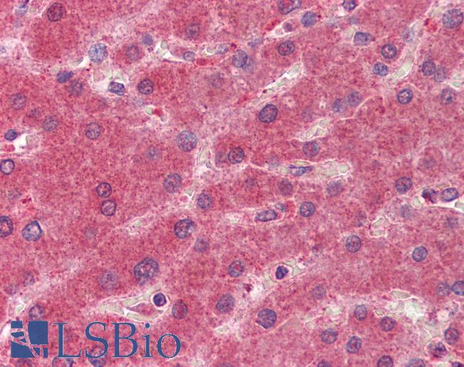 15-PGDH / HPGD Antibody - Anti-HPGD / 15-PGDH antibody IHC of human liver. Immunohistochemistry of formalin-fixed, paraffin-embedded tissue after heat-induced antigen retrieval. Antibody concentration 2.5 ug/ml.