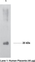 15-PGDH / HPGD Antibody - Western blot of 15-PGDH / HPGD antibody.