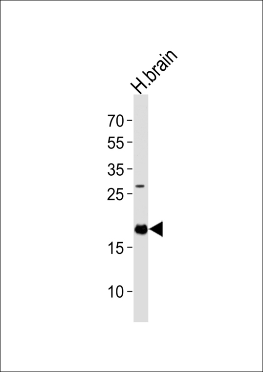 4E-BP2 / EIF4EBP2 Antibody - Western blot of lysate from human brain tissue lysate, using EIF4EBP2 Antibody. Antibody was diluted at 1:1000 at each lane. A goat anti-rabbit IgG H&L (HRP) at 1:5000 dilution was used as the secondary antibody. Lysate at 35ug per lane.